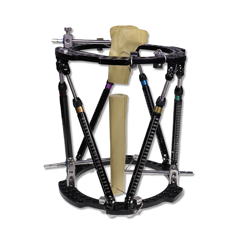 Trauma External Fixators
